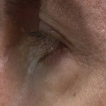 eye-tracking