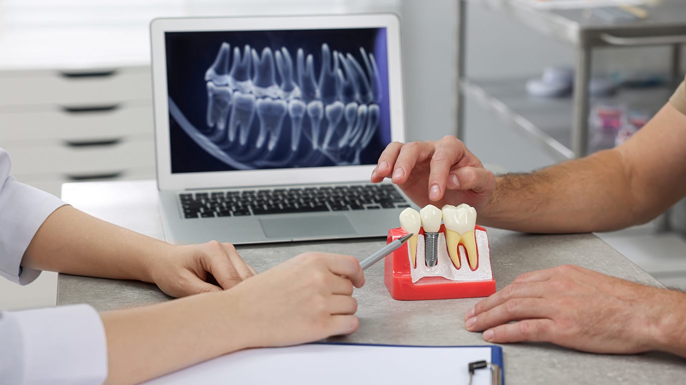Best dental implants in Huntington NY: Top 10 choices (2026) - AZ