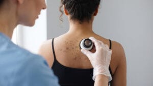 Skin cancer warning signs you shouldn’t ignore